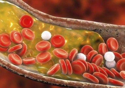 ����������� ������� �������� ����������� ��� ������